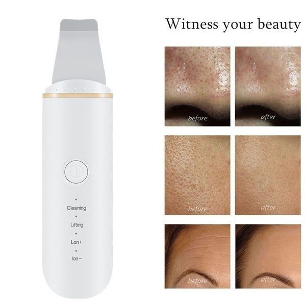 Remove blackheads, cleanse and lift with Agaro Ultrasonic Facial Skin  Scrubber 