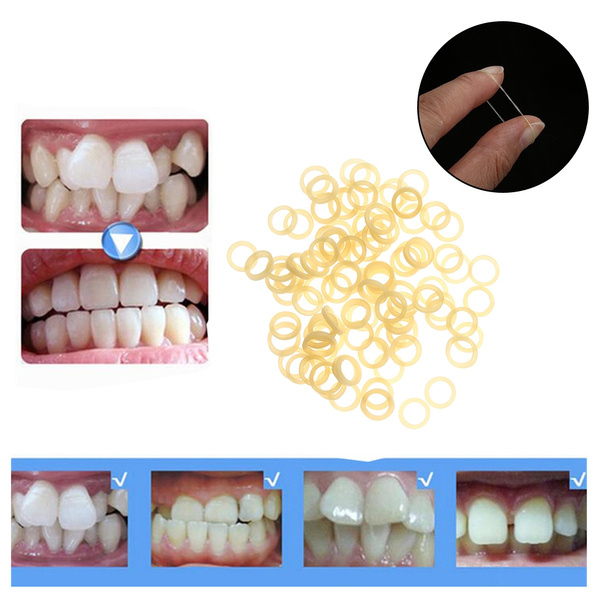 Teeth rubber online bands