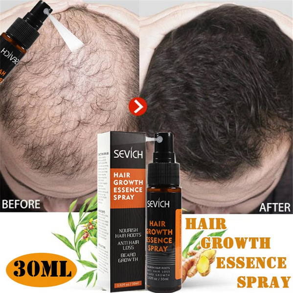 1 Piece 30ml Herbal Hair Growth Essence Spray Hair Loss Products Help for Hair Growth Hair Grwoth Spray Hair Care | Wish 1 Piece 30ml Herbal Hair Growth Essence Spray Hair Loss Products Help for Hair Growth Hair Grwoth Spray Hair Care | Wish