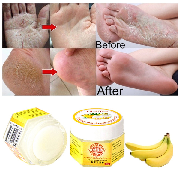 Anti Fungal Foot Repair Foot Cream Dead Skin Removal Peeling