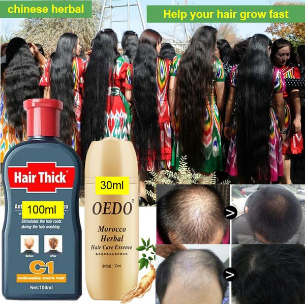 100ml /30ml Hair Care Product Herbs Anti Hair Loss Hair Growth Essence  Shampoo Beauty Fashion Hair Growth Fluid | Wish