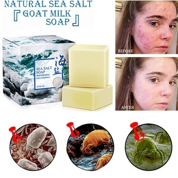 sea salt soap for acne