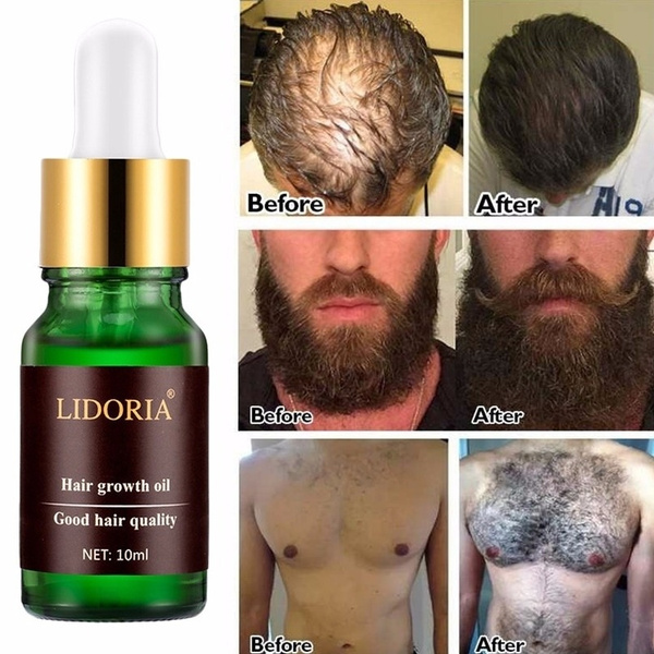 Hair Loss Products Natural With No Side Effects Grow Hair Faster ...