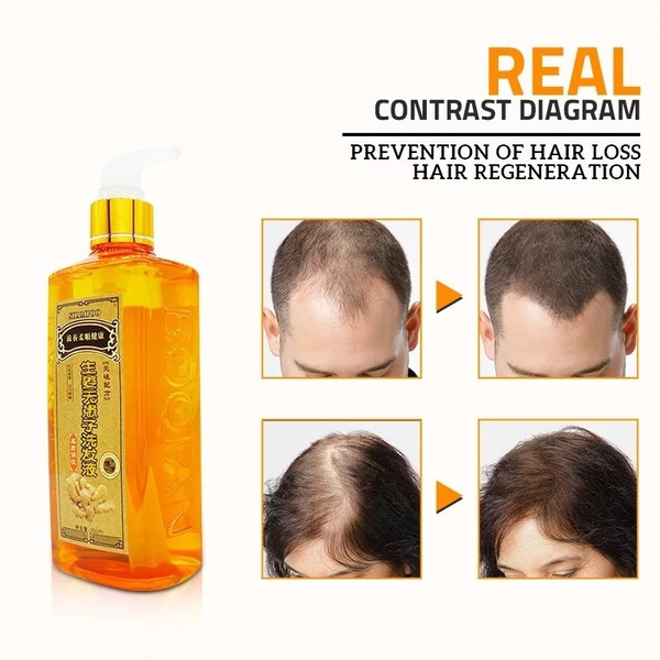 300mL Professional Ginger Shampoo Anti-Hair Loss Anti Hair Baldness Natural Hair  Regrowth Repair Nourish Supple Shampoo Dandruff Shampoo Product CR9 | Wish