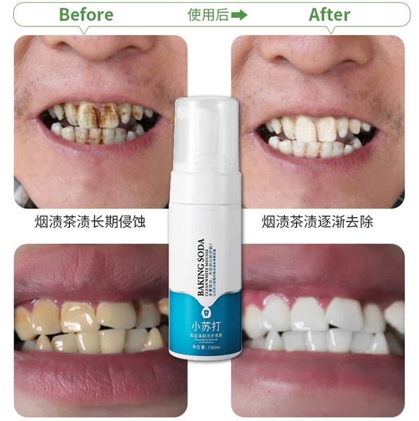 Clean Teeth Mousse To Yellow Teeth Whitening Teeth Oral Cleaning Liquid Oral Care Teeth Whitening Remove Stains Stains Stains Stains Tea Stains Coffee Stains Food Stains Wish