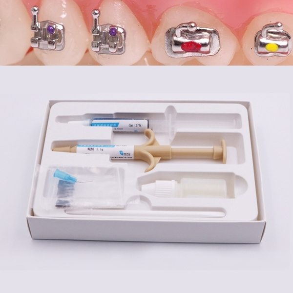 Dental LightCure Adhesive Bonding System Orthodontic Adhesive For