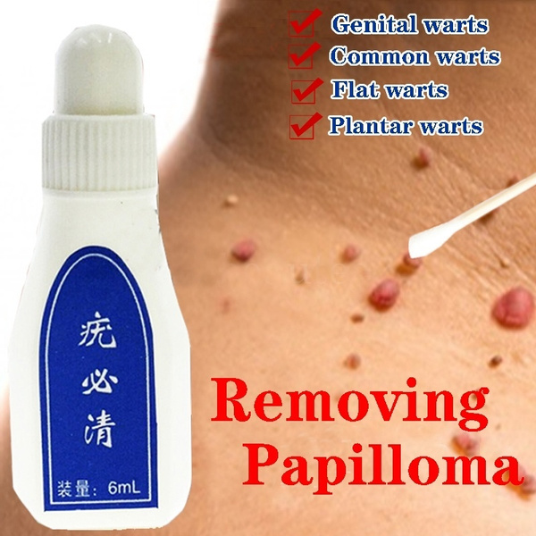 How to remove papilloma warts