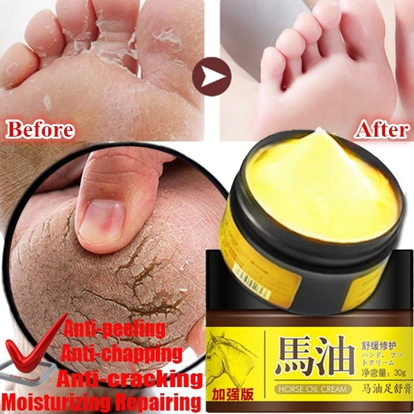 1pcs 30g Anti Dry Crack Skin Ointment Cream Horse Oil Hand Foot Crack Cream Heel Chapped Peeling Foot Hand Repair Wish