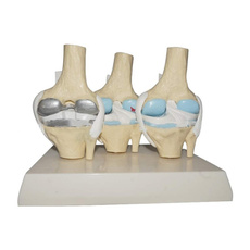 anatomy, skeletonmodel, humankneejointmodel, knee