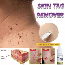 Skincare, wart, footcornremover, removal