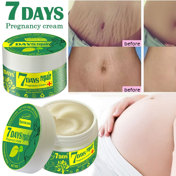 striae treatment cream