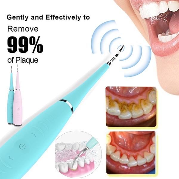sonic dental scaler tooth calculus remover