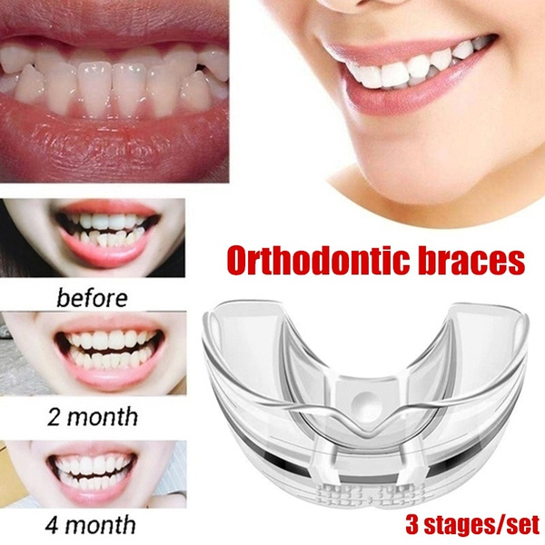 3 Stages Tooth Orthodontic Appliance Silicone Dentista Material ...