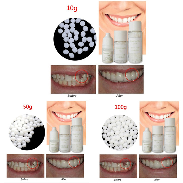 50g Temporary Tooth Repair Kit Teeth And Gaps FalseTeeth Solid Glue Denture  Adhesive 