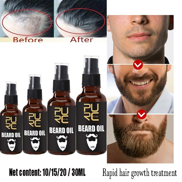 Defeat Beard Acne: How to Get Rid of Pimples Under Your Facial Hair