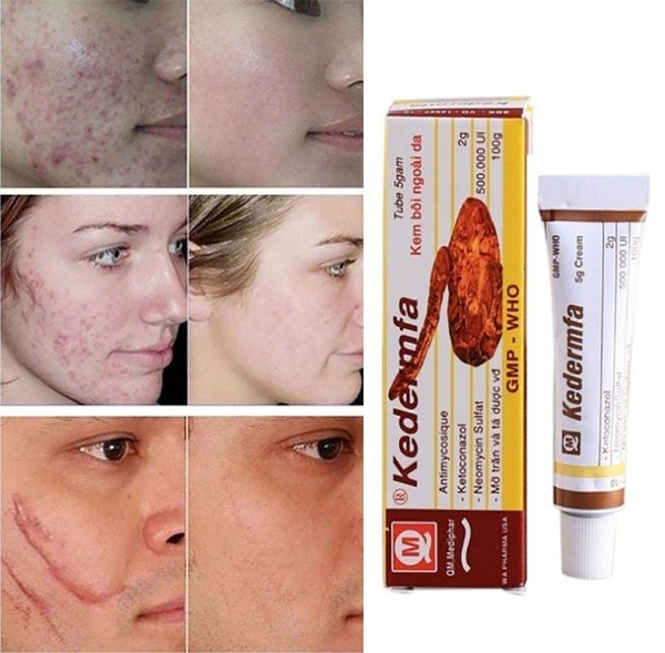 pigmentation corrector cream