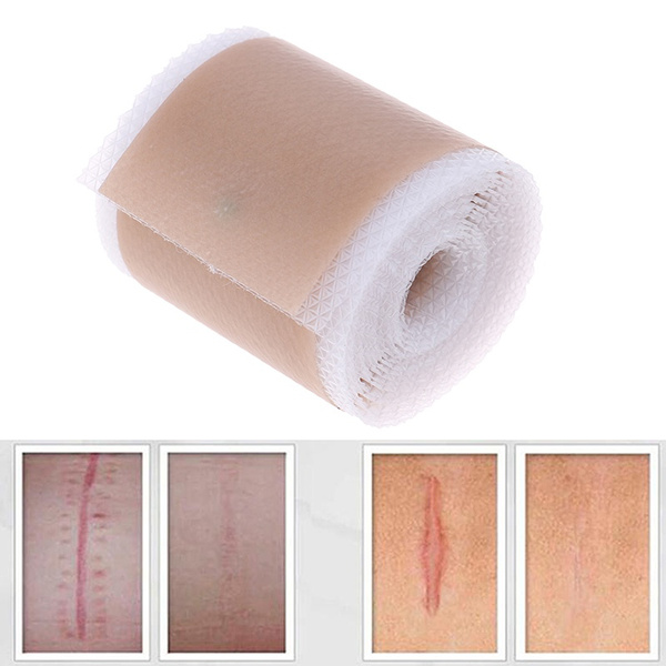 4x150cm Efficient Surgery Scar Removal Silicone Gel Sheet Patch Bandage Tape~GQ 