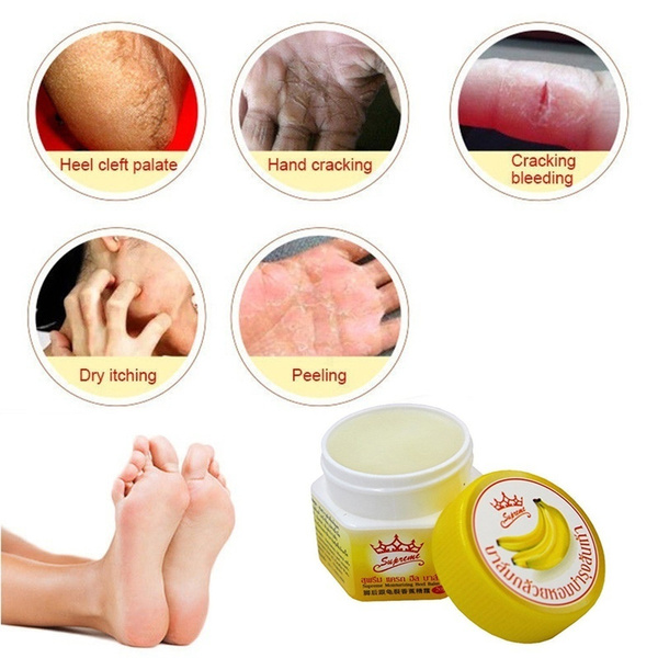 Anti Fungal Foot Repair Foot Cream Dead Skin Removal Peeling