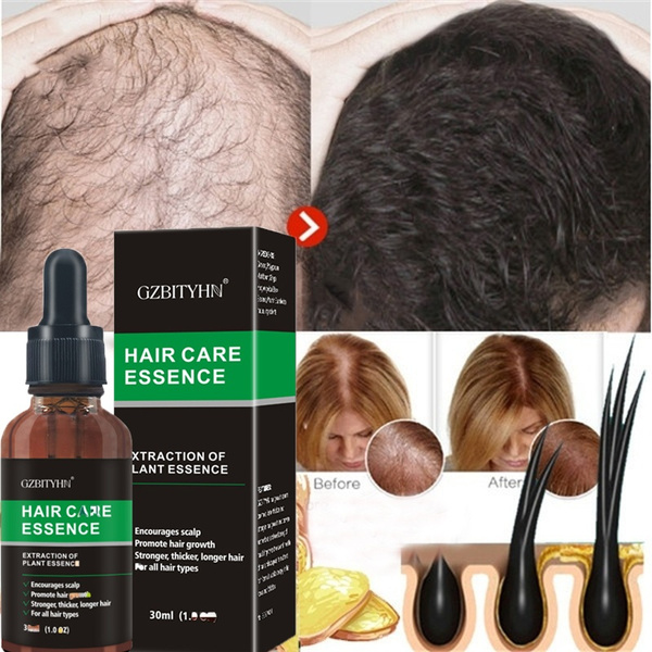 1pc Ginger Multiflorum Extract Hair Growth Essence Nourishing Hair 1pc Ginger Multiflorum Extract Hair Growth Essence Nourishing Hair
