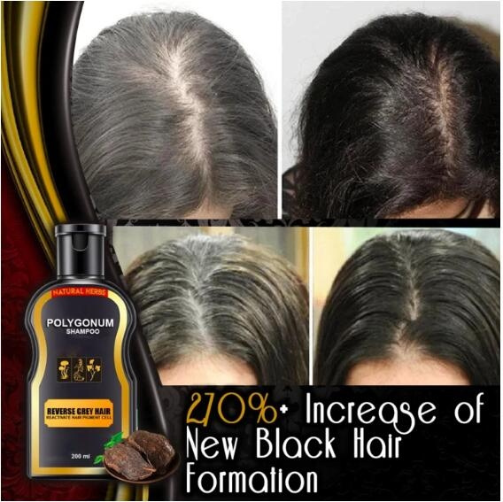 30/200ML Natural Soft Shiny Hair Hair Darkening Shampoo For Women Men | Wish