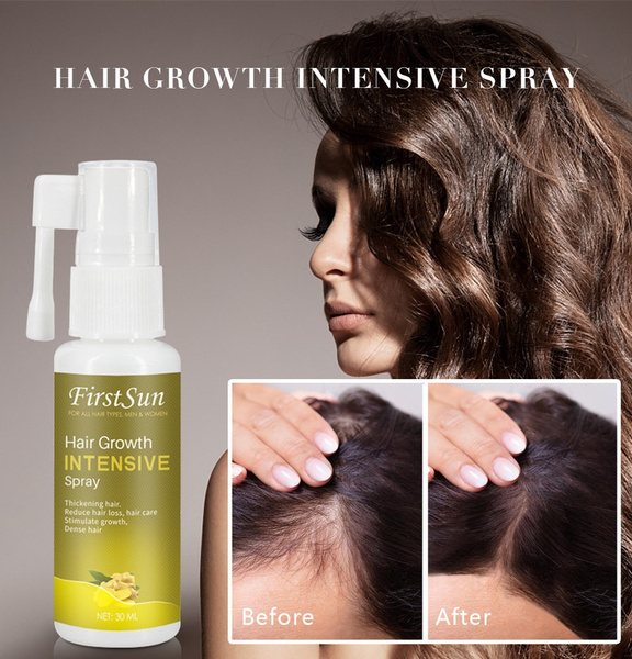 30 ML Hair Growth Essence Essential Oil Liquid Spray Nourish Roots Thick Shiny Prevent Hair Loss Anti-hair for Men Women | Wish 30 ML Hair Growth Essence Essential Oil Liquid Spray Nourish Roots Thick Shiny Prevent Hair Loss Anti-hair for Men Women | Wish