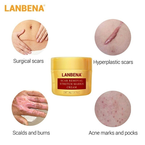 lanbena stretch mark