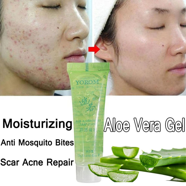 Moisturizing 13g Beauty Natural Skin Care Damage Itching Cream Acne Remove  Scar Acne Repair 100% Aloe Vera Gel | Wish
