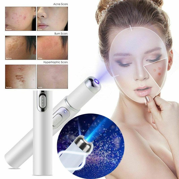 Medical Blue Light Therapy Laser Treatment Pen Acne Scar Wrinkle