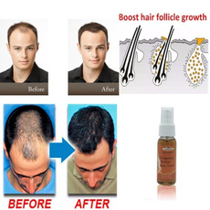 fasthairgrowth, healthampbeauty, hairlossproduct, Men