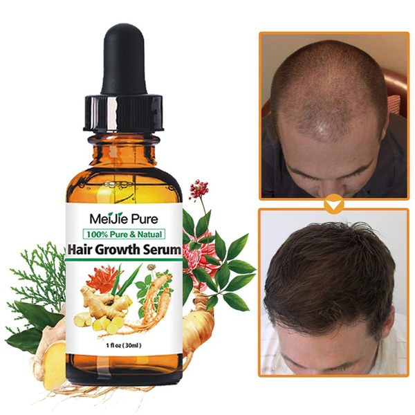 Hair Growth Serum 2020 Hair Growth Treatment Hair Serum Anti Hair Loss Thinning Balding Repairs Hair Follicles Promotes Thicker Stronger Hair And Promotes Hair Regrowth Wish