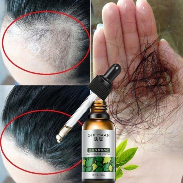 Hair Growth Essential Oil Nourish Hair Repairs Hair Follicles And Damaged Hair Hair Growth Care | Wish Hair Growth Essential Oil Nourish Hair Repairs Hair Follicles And Damaged Hair Hair Growth Care | Wish