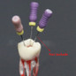 thumbnail - 1