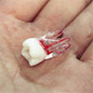 thumbnail - 3