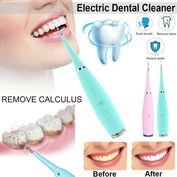 Electric Tooth Cleaner Ultrasonic Oral Irrigator Teeth Stain Dental  Cleaning Kit Electric Sonic Dental Scaler Tartar Calculus Plaque Remover  Tooth ...
