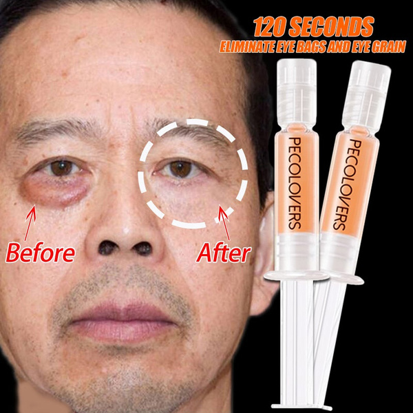 male eye bag removal cream