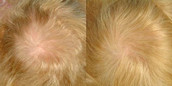 thumbnail - 2