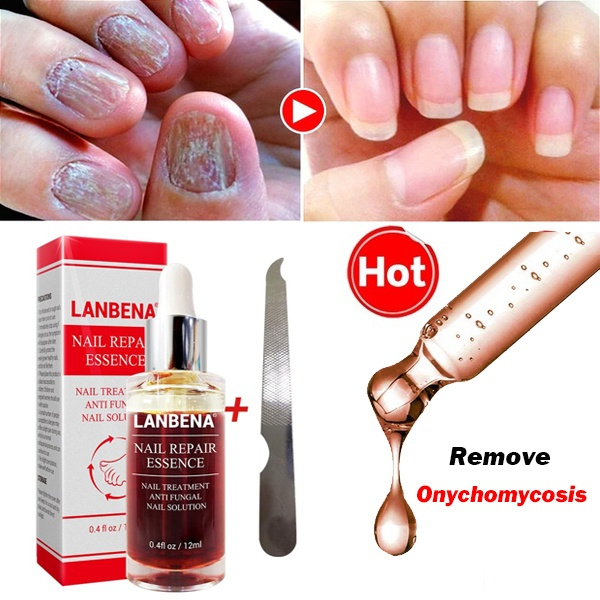 lanbena nail repair