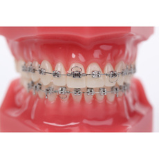 orthodonticappliance, orthodontictorquespring, orthodonticgoodmanspring, orthodonticsupplier