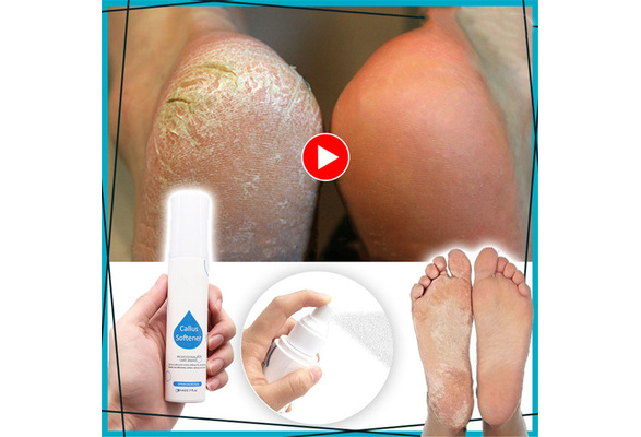 Skin softener hot sale for feet