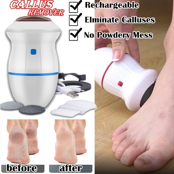 Vacuum Callus Remover