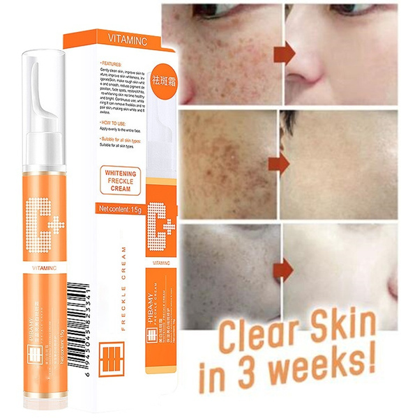 whitening freckle cream