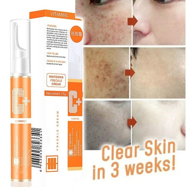scobuty whitening freckle cream