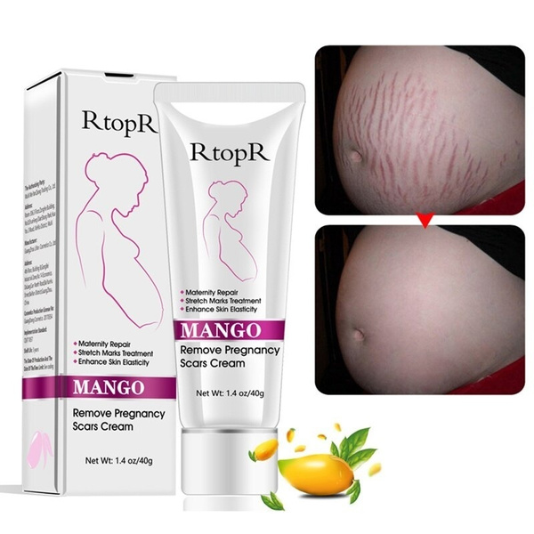 natural-mild-non-irritating-mango-stretch-mark-cream-for-pregnancy