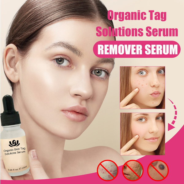 skin mole removal cream