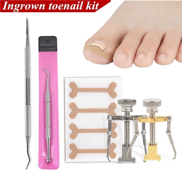 1 Set Professional Toenail Straightening Paronychia Pedicure Tool