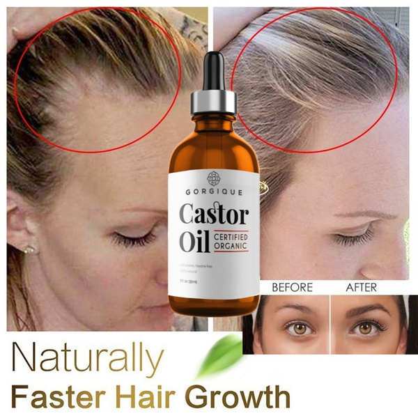 10/20/30/50ml Nourish Castor Oil Hair Growth Skin Massage Essential Oil  Eyebrows Growth Prevent Skin Aging Castor Organic Serum | Wish