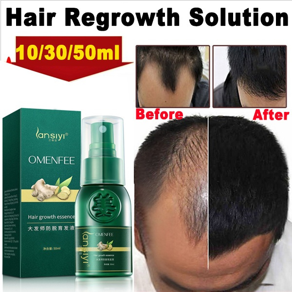 Best 100%all Natural 10ml/30ML/50ML New Hair Growth Spray Fast Grow Hair  Anti Hair Loss Treatment Preventing Hair Growth Products | Wish
