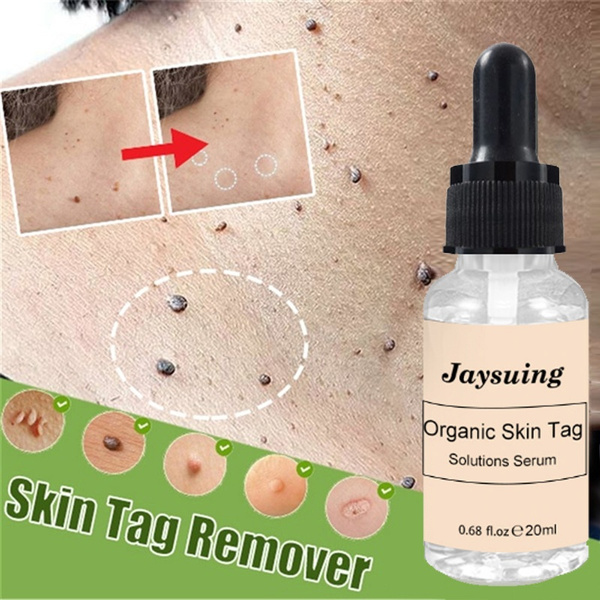 skin tag solution serum