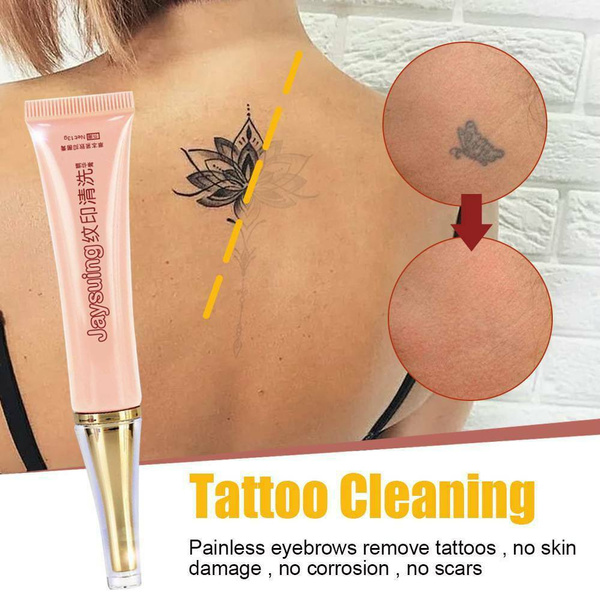 Renewal Tattoo Removal – Safe, Fast, Complete Tattoo Removal