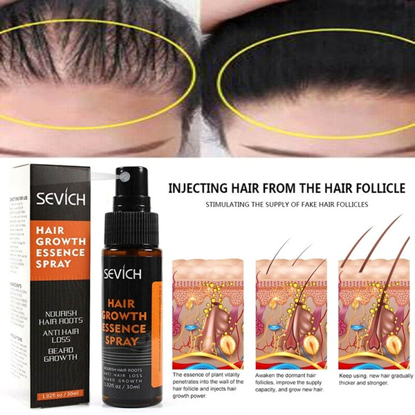 30Ml Hair Growth Spray Natural Hair Regrowth Essence Intensive Spray Hair Loss Products Hair Grow Faster Serum Repair Scalp | Wish 30Ml Hair Growth Spray Natural Hair Regrowth Essence Intensive Spray Hair Loss Products Hair Grow Faster Serum Repair Scalp | Wish